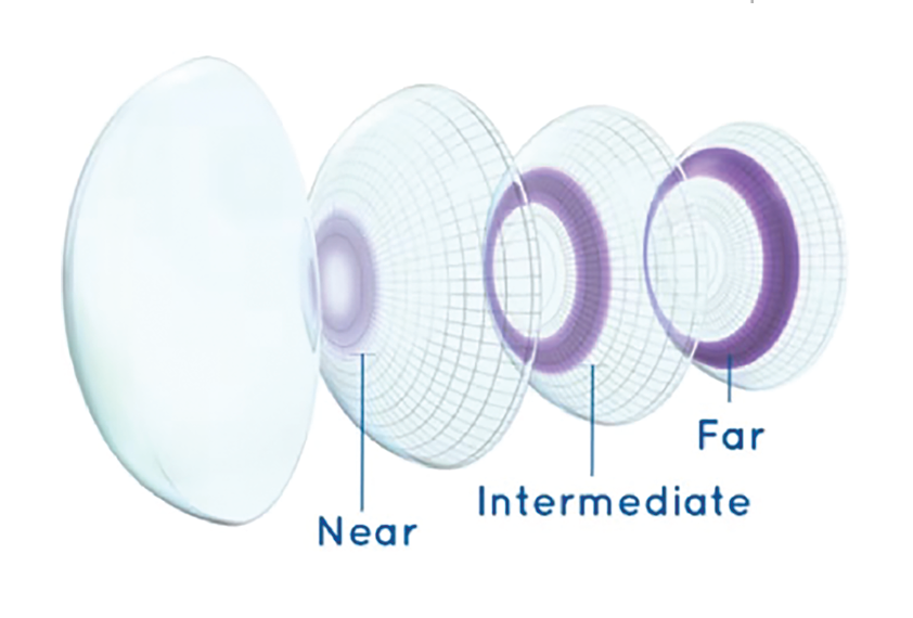 THE FREEDOM OF MULTIFOCAL CONTACT LENSES